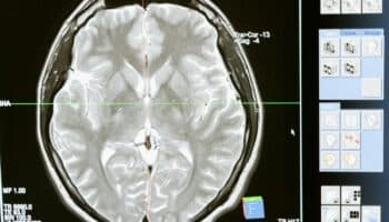 La microglía y su posible papel en la prevención del Alzheimer: Carlos Páez | Video