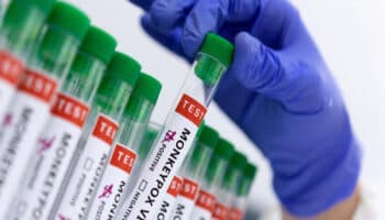 Aumentan 89% los casos de mpox en Europa: OMS | Video