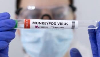 No más viruela del mono: la OMS busca renombrar a la enfermedad para evitar estigmas