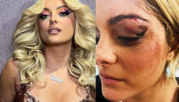 Golpean a Bebe Rexha en pleno concierto | Video