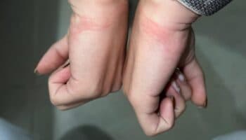 'Atacaron a mi mamá de 87 años': Notario Jorge Alberto Merlo | Video