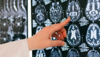 Los cerebros de hombres y mujeres se organizan de forma diferente, señala estudio basado en IA