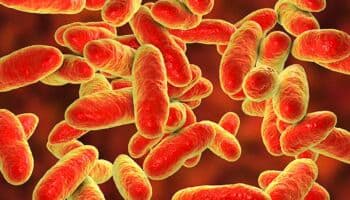 Contaminación por bacteria en Edomex probablemente se produjo durante la preparación de alimentos: infectólogo
