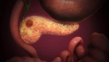 Eliminan, por primera vez, el cáncer de páncreas en ratones