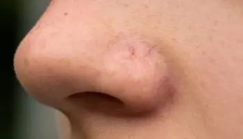 Alucinaciones Olfativas #Niñonautas con Kirén Miret