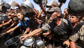 Gaza: Once muertes más por desnutrición elevan a 300 el total de víctimas de hambre