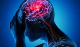 ¿Es posible predecir una crisis de migraña días antes del dolor? Médicos analizan sus 4 fases