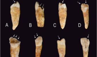 Marcas en los dientes revelan cómo se construían las identidades de género en la Prehistoria, según un estudio